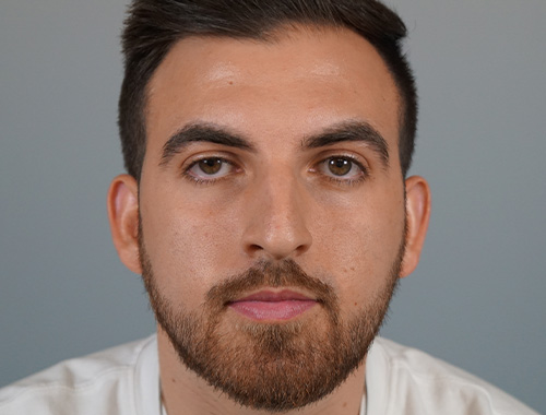 Case #686 Before image