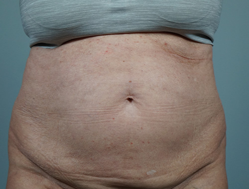 Case #682 Before image