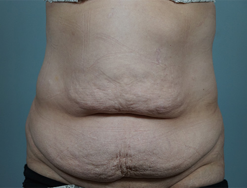 Case #683 Before image