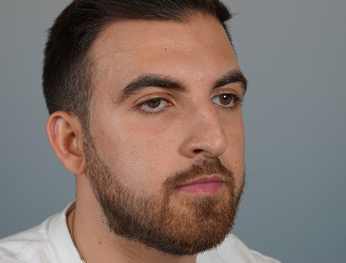 Case #686 Before image