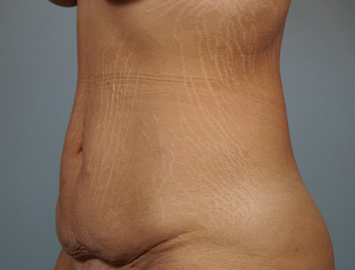 Case #680 Before image