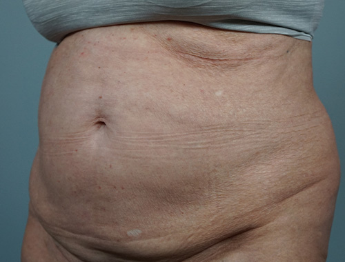 Case #682 Before image