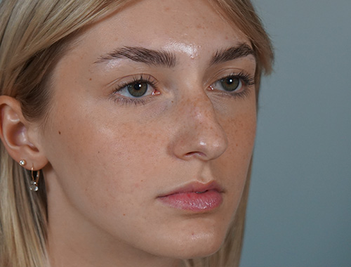 Case #684 Before image