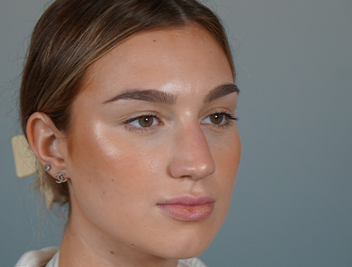 Case #689 Before image