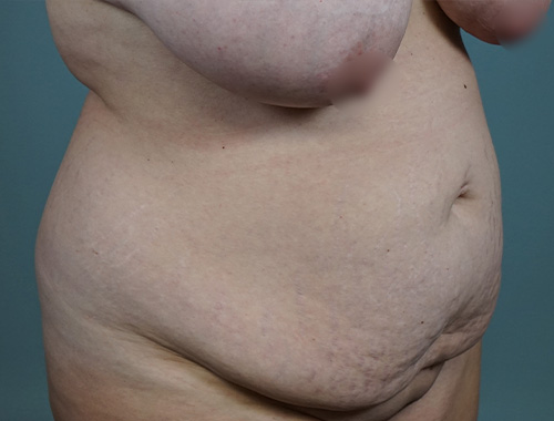 Case #693 Before image