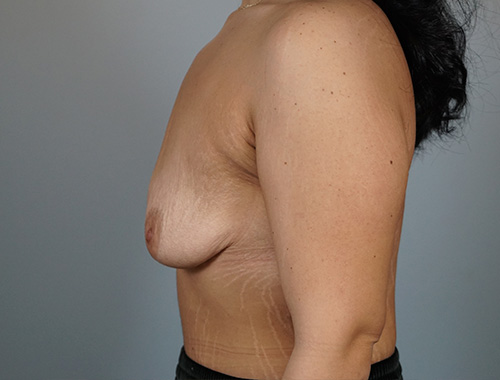 Case #685 Before image