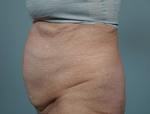 Case #682 Before image