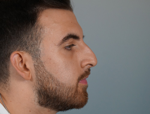 Case #686 Before image