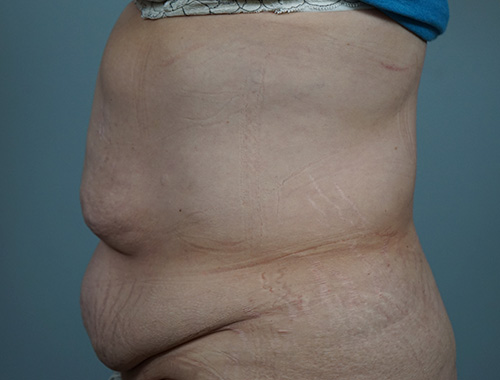 Case #683 Before image