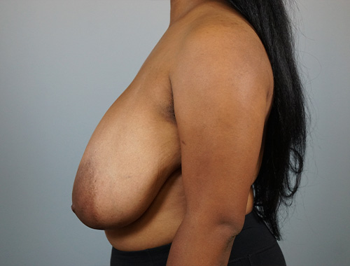 Case #688 Before image