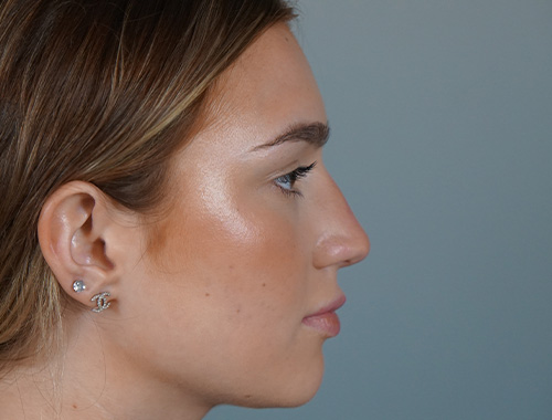 Case #689 After image