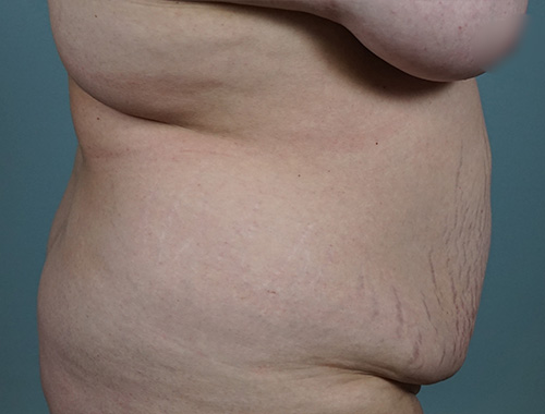 Case #693 Before image