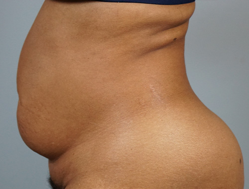 Case #695 Before image