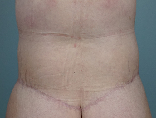 Case #683 After image