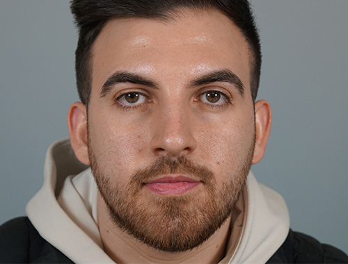 Case #686 After image