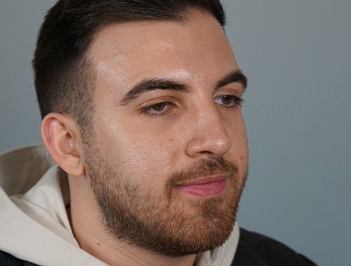 Case #686 After image