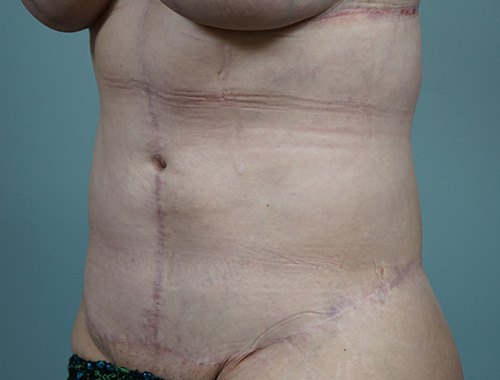 Case #683 After image