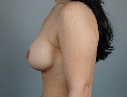 Case #685 After image