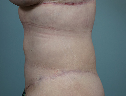 Case #683 After image