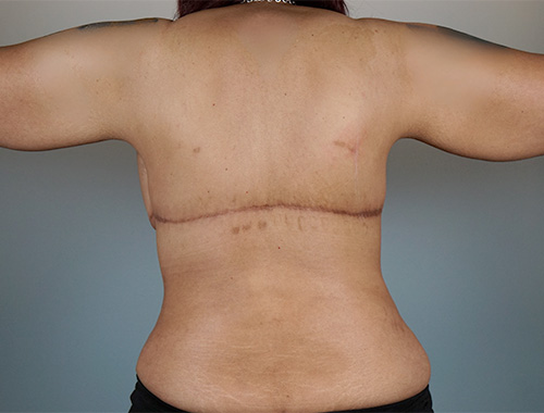 Case #701 After image