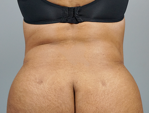 Case #699 After image