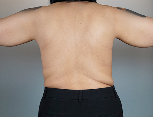 Case #701 Before image