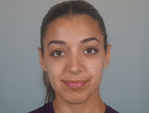 Case #708 After image