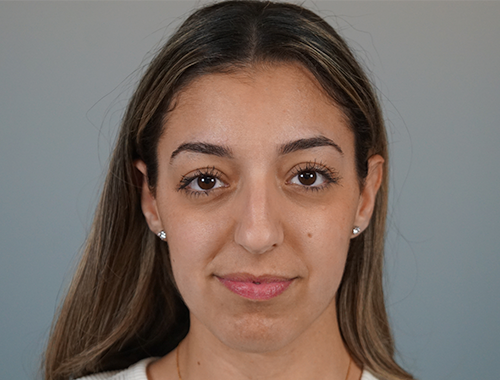 Case #708 Before image