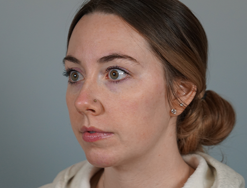 Case #704 After image