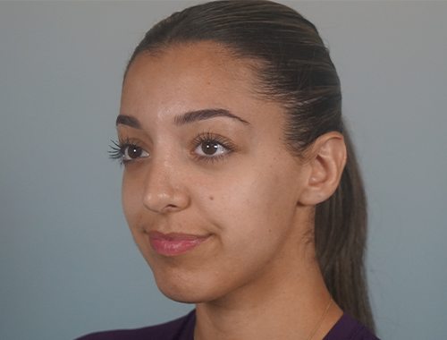 Case #708 After image