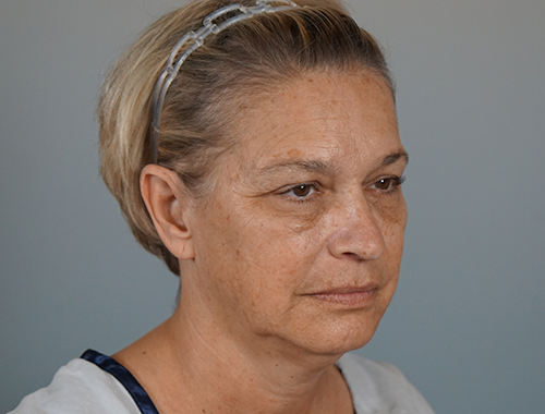 Case #706 Before image