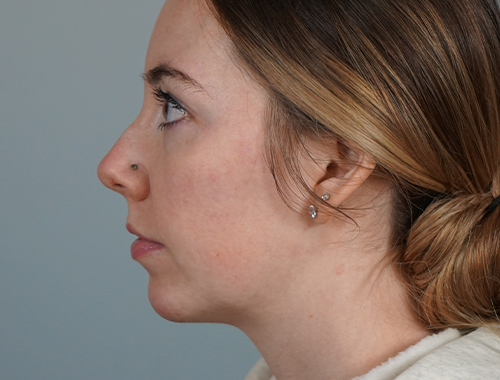 Case #704 After image