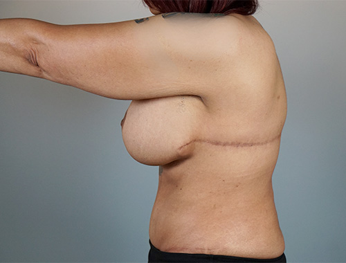 Case #701 After image