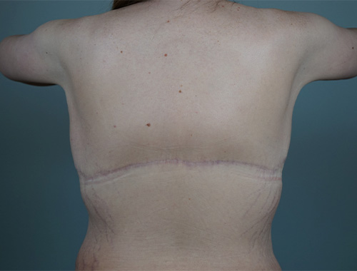 Case #710 After image