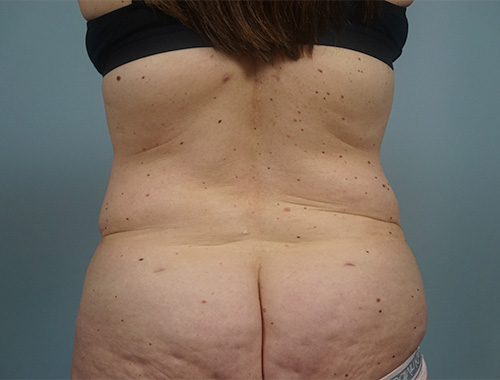 Case #714 After image