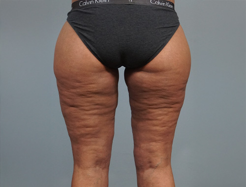 Case #717 After image