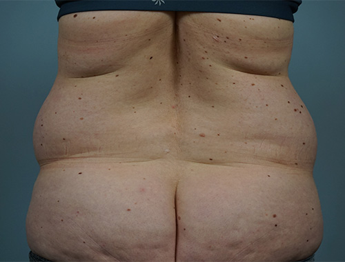 Case #714 Before image