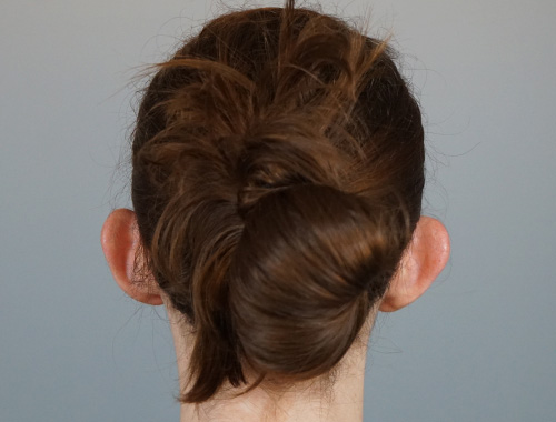 Case #718 Before image