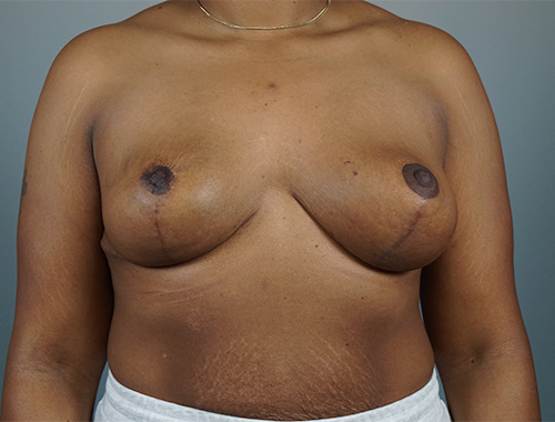 Case #711 After image