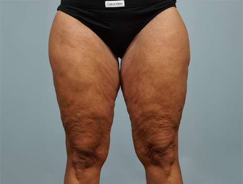 Case #717 Before image