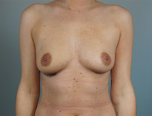 Case #710 Before image