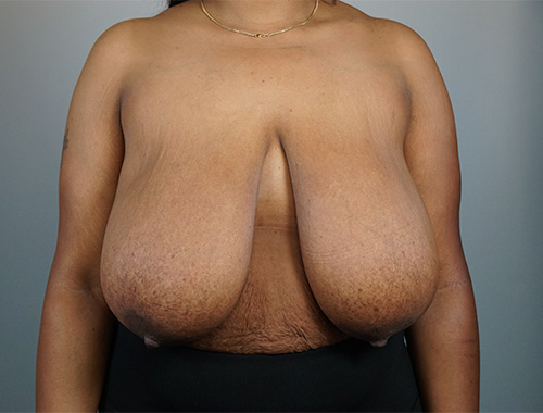 Case #711 Before image