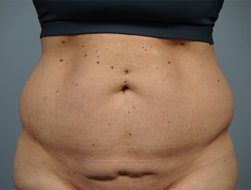 Case #714 Before image