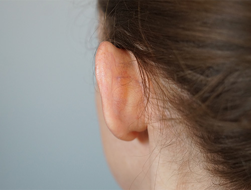 Case #718 Before image