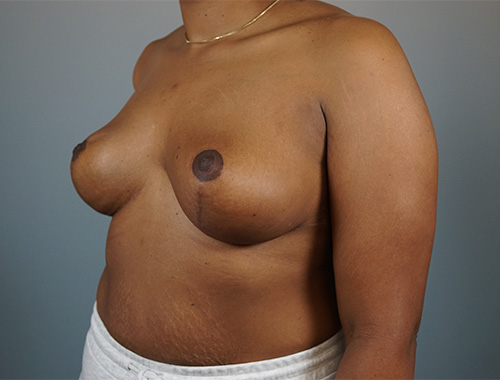 Case #711 After image