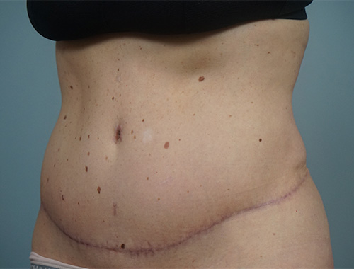 Case #714 After image