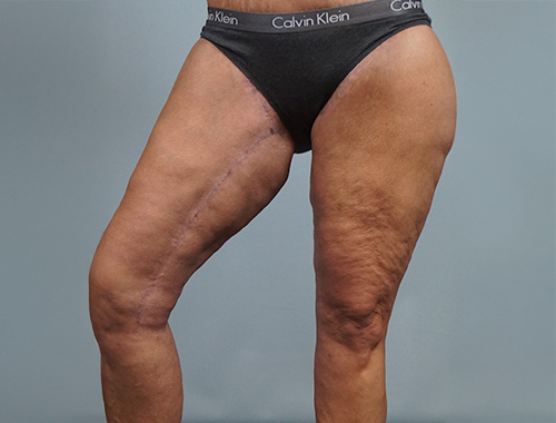 Case #717 After image