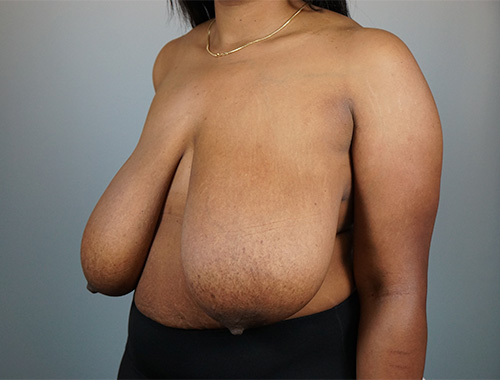 Case #711 Before image