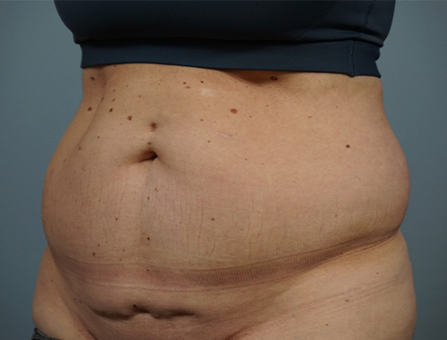 Case #714 Before image