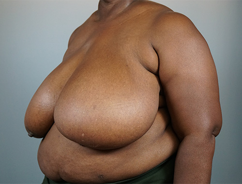 Case #716 Before image